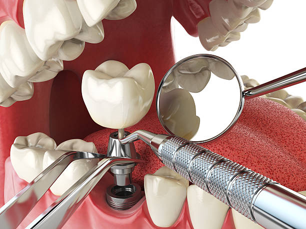 Best After-Hours Emergency Dentist in Sanford, NC
